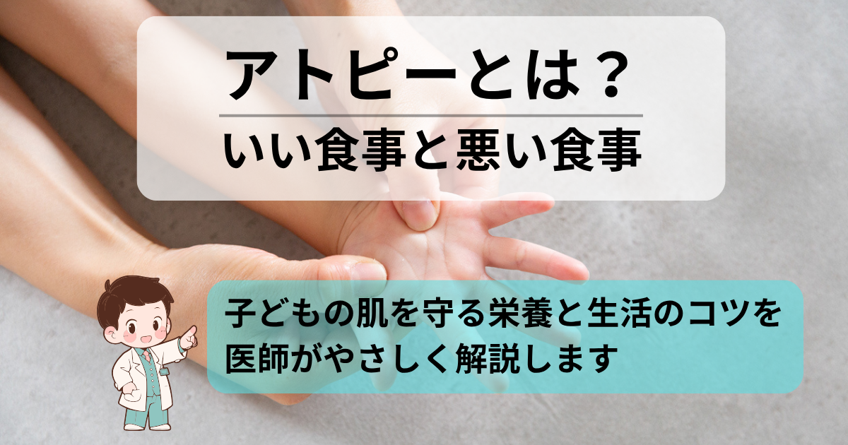 子どものアトピーに良い食事と悪い食事を医師がやさしく解説するアイキャッチ画像。子どもの肌を守る栄養と生活のコツを紹介。