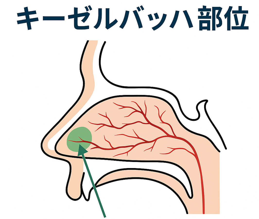 鼻出血の好発部位であるキーゼルバッハ部位を示すイラスト